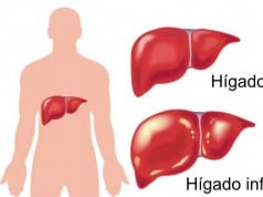 tipos de hepatitis