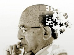 Alzheimer precoz Alzheimer precoz